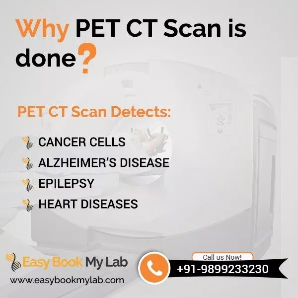 pet ct scan in delhi